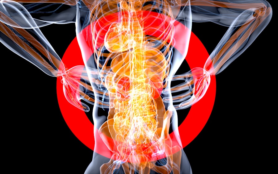 Spinal cord injury compensation