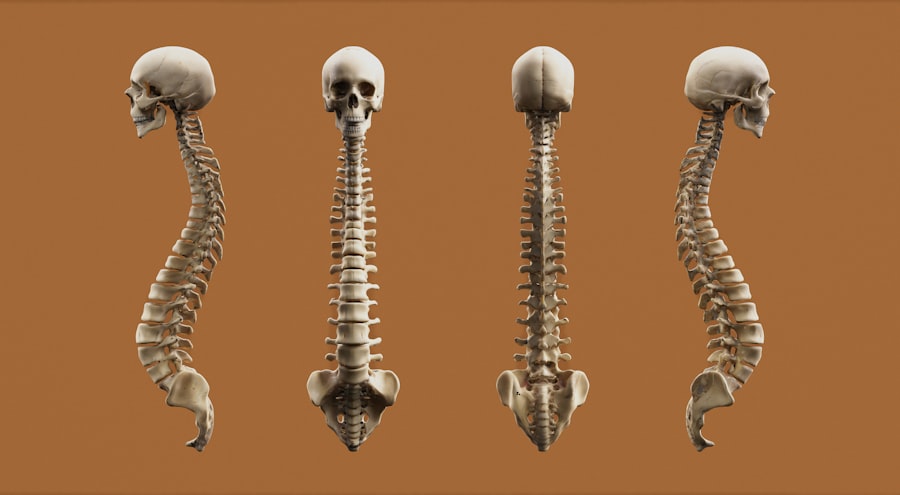 Photo Spinal cord injury compensation